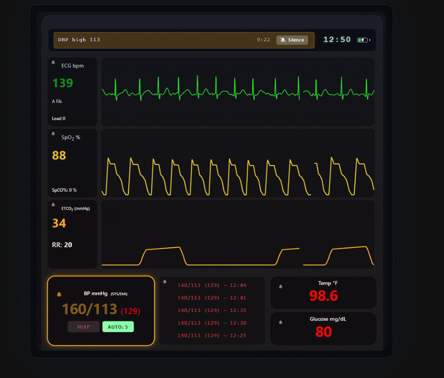 Free Alternative to Paid ECG Rhythm Generators